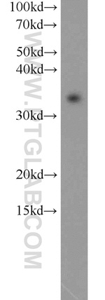 MBD3 Antibody in Western Blot (WB)