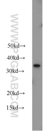 MBD3 Antibody in Western Blot (WB)