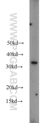 MBD3 Antibody in Western Blot (WB)