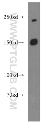 PNPLA6 Antibody in Western Blot (WB)