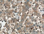 ARNTL Antibody in Immunohistochemistry (Paraffin) (IHC (P))