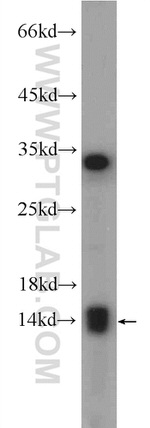 SRX1 Antibody in Western Blot (WB)
