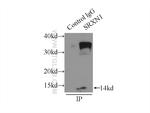 SRX1 Antibody in Immunoprecipitation (IP)