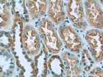 GFM1 Antibody in Immunohistochemistry (Paraffin) (IHC (P))