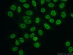 FBXO18 Antibody in Immunocytochemistry (ICC/IF)