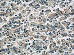 CNOT1 Antibody in Immunohistochemistry (Paraffin) (IHC (P))