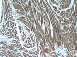 CNOT1 Antibody in Immunohistochemistry (Paraffin) (IHC (P))