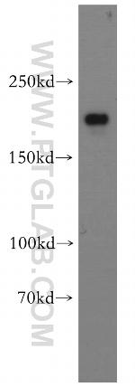 CNOT1 Antibody in Western Blot (WB)