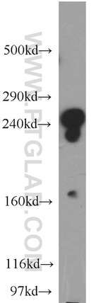 CNOT1 Antibody in Western Blot (WB)