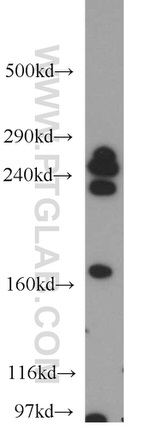 CNOT1 Antibody in Western Blot (WB)