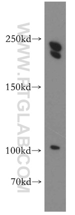 CNOT1 Antibody in Western Blot (WB)