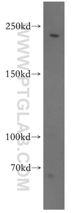 CNOT1 Antibody in Western Blot (WB)