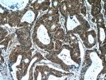 ZWILCH Antibody in Immunohistochemistry (Paraffin) (IHC (P))