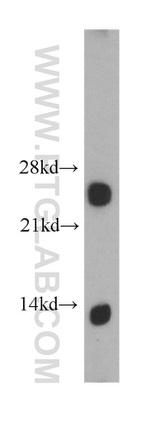 ARHGDIG Antibody in Western Blot (WB)