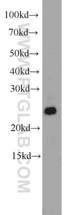 ARHGDIG Antibody in Western Blot (WB)