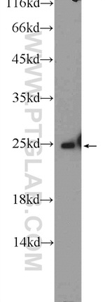 ARHGDIG Antibody in Western Blot (WB)