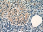 RAB26 Antibody in Immunohistochemistry (Paraffin) (IHC (P))