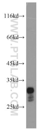 RAB26 Antibody in Western Blot (WB)