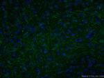 LRRTM1 Antibody in Immunohistochemistry (PFA fixed) (IHC (PFA))