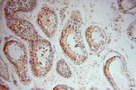 LRRTM1 Antibody in Immunohistochemistry (Paraffin) (IHC (P))