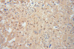 Renin Antibody in Immunohistochemistry (Paraffin) (IHC (P))