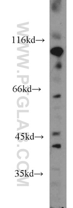 Renin Antibody in Western Blot (WB)