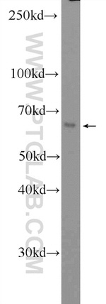 CD80/B7-1 Antibody in Western Blot (WB)