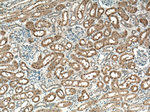 FN3K Antibody in Immunohistochemistry (Paraffin) (IHC (P))