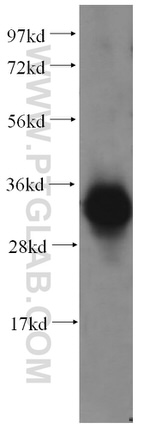 FN3K Antibody in Western Blot (WB)