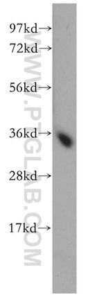 FN3K Antibody in Western Blot (WB)