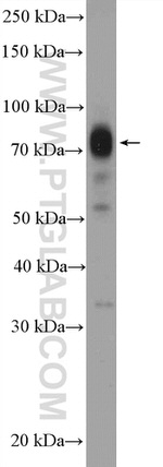 APPL2 Antibody in Western Blot (WB)