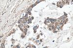 GLUD1 Antibody in Immunohistochemistry (Paraffin) (IHC (P))