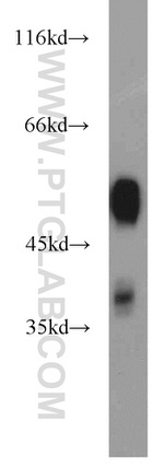 GLUD1 Antibody in Western Blot (WB)