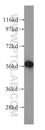 GLUD1 Antibody in Western Blot (WB)