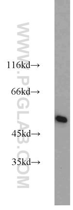 GLUD1 Antibody in Western Blot (WB)