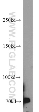 ACK1 Antibody in Western Blot (WB)