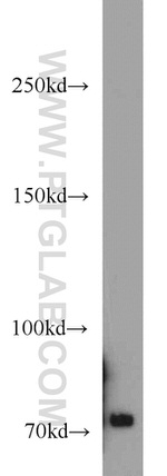 ACK1 Antibody in Western Blot (WB)