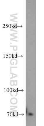 ACK1 Antibody in Western Blot (WB)