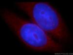 WASL Antibody in Immunocytochemistry (ICC/IF)