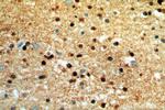 WASL Antibody in Immunohistochemistry (Paraffin) (IHC (P))