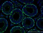 DMRT1 Antibody in Immunohistochemistry (Paraffin) (IHC (P))