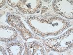 DMRT1 Antibody in Immunohistochemistry (Paraffin) (IHC (P))