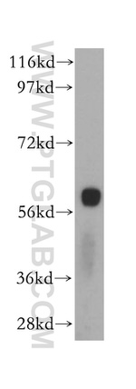 SLC38A3 Antibody in Western Blot (WB)