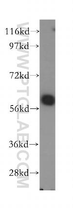 SLC38A3 Antibody in Western Blot (WB)