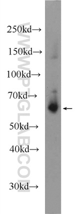 SLC38A3 Antibody in Western Blot (WB)