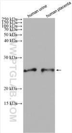 SOD3 Antibody in Western Blot (WB)