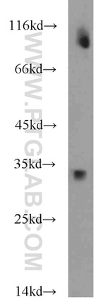 SOD3 Antibody in Western Blot (WB)