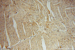 Thrombomodulin Antibody in Immunohistochemistry (Paraffin) (IHC (P))