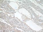 Thrombomodulin Antibody in Immunohistochemistry (Paraffin) (IHC (P))