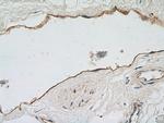 Thrombomodulin Antibody in Immunohistochemistry (Paraffin) (IHC (P))